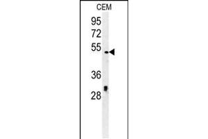 Western blot analysis in CEM cell line lysates (35ug/lane). (DSCC1 抗体  (C-Term))