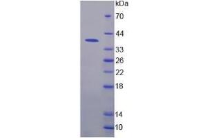 SDS-PAGE analysis of Human Nuclear Factor kappa B Protein. (NFkB 蛋白)