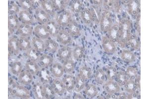 Immunohistochemistry (IHC) image for anti-Optic Atrophy 3 (Autosomal Recessive, with Chorea and Spastic Paraplegia) (OPA3) (AA 1-200) antibody (ABIN5014055)