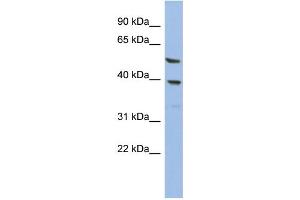 WB Suggested Anti-OLAH Antibody Titration: 0. (OLAH 抗体  (N-Term))