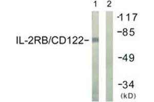 Western blot analysis of extracts from COS7 cells, using IL-2R beta/CD122 (Ab-364) Antibody. (IL2 Receptor beta 抗体  (AA 331-380))