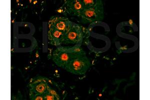 Formalin-fixed and paraffin-embedded rat skin labeled with Anti-? (beta Catenin 抗体  (AA 661-781))
