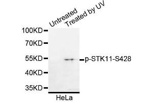 Western blot analysis of extracts of HeLa cells, using Phospho-STK11-S428 antibody (ABIN5995629). (LKB1 抗体  (pSer428))