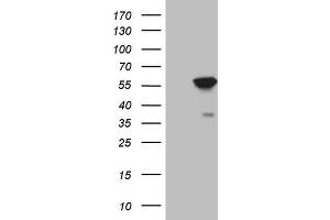 Western Blotting (WB) image for anti-4-Aminobutyrate Aminotransferase (ABAT) (AA 29-323) antibody (ABIN2715600) (ABAT 抗体  (AA 29-323))