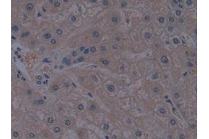 Immunohistochemistry (IHC) image for anti-Toll-Like Receptor Adaptor Molecule 1 (TICAM1) (AA 443-685) antibody (ABIN7441424)