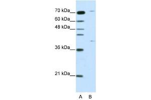 ZNF668 antibody (20R-1224) used at 0. (ZNF668 抗体  (C-Term))
