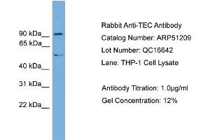 Western Blotting (WB) image for anti-Nuclear Receptor Subfamily 4, Group A, Member 3 (NR4A3) (Middle Region) antibody (ABIN2784460)