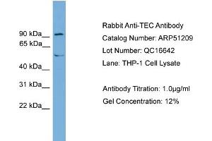 WB Suggested Anti-TEC  Antibody Titration: 0. (NR4A3 抗体  (Middle Region))