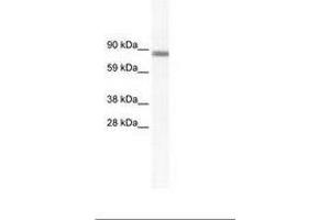 Image no. 1 for anti-GATA Zinc Finger Domain Containing 2A (GATAD2A) (N-Term) antibody (ABIN202841) (GATAD2A 抗体  (N-Term))