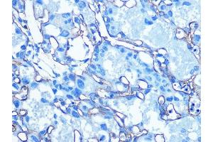 Immunohistochemistry of paraffin-embedded Mouse placenta using GLUT1/SLC2 antibody (ABIN6129475, ABIN6147954, ABIN6147956 and ABIN6222743) at dilution of 1:100 (40x lens). (GLUT1 抗体  (AA 210-310))