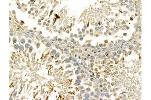 ABIN6261297 and ABIN6273041 at 1/100 staining Rat testis tissue by IHC-P.