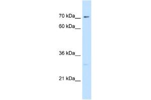 WB Suggested Antibody Titration:  5. (CTP Synthase 抗体  (N-Term))