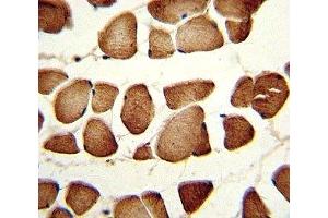 IHC analysis of FFPE human skeletal muscle stained with NAMPT antibody (NAMPT 抗体  (AA 400-426))