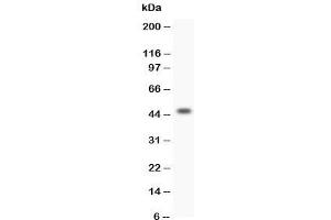 Western blot testing of HOXA3 antibody and SW620 lysate (HOXA3 抗体  (C-Term))
