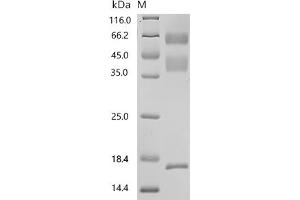 (Tris-Glycine gel) Discontinuous SDS-PAGE (reduced) with 5 % enrichment gel and 15 % separation gel.