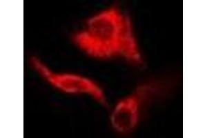 Immunofluorescent analysis of GDA staining in A549 cells. (GDA 抗体)