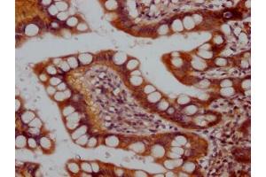 IHC image of ABIN7127787 diluted at 1:100 and staining in paraffin-embedded human small intestine tissue performed on a Leica BondTM system. (Recombinant Raptor 抗体)