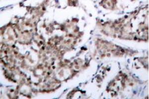 Image no. 1 for anti-BCL2-Associated Agonist of Cell Death (BAD) (pSer118), (pSer155) antibody (ABIN317970)