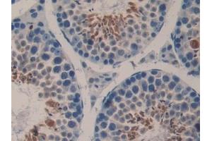 Detection of LAMb3 in Mouse Testis Tissue using Polyclonal Antibody to Laminin Beta 3 (LAMb3) (Laminin beta 3 抗体  (AA 367-568))
