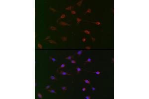 Immunofluorescence analysis of BALB-3T3 cells using CDC34 Rabbit pAb (ABIN6131558, ABIN6138257, ABIN6138258 and ABIN6221114) at dilution of 1:100 (40x lens). (CDC34 抗体  (AA 1-236))