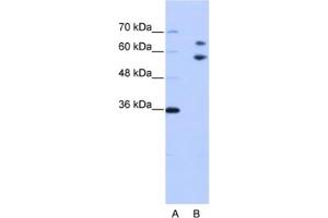 Western Blotting (WB) image for anti-TROVE Domain Family, Member 2 (TROVE2) antibody (ABIN2462170) (TROVE2 抗体)