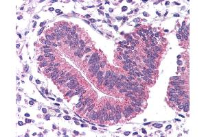 Immunohistochemistry (IHC) image for anti-Signal Transducer and Activator of Transcription 3 (Acute-Phase Response Factor) (STAT3) (N-Term) antibody (ABIN2780479)
