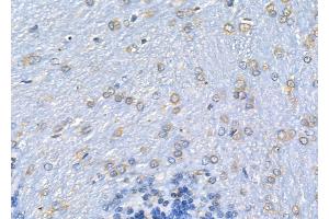 ABIN6262435 and ABIN6278088 at 1/100 staining Rat brain tissue by IHC-P. (ICAM-3/CD50 抗体  (Internal Region))