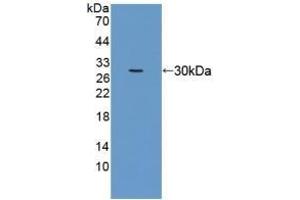 Detection of Recombinant EEF1a1, Human using Polyclonal Antibody to Eukaryotic Translation Elongation Factor 1 Alpha 1 (EEF1a1) (eEF1A1 抗体  (AA 1-241))