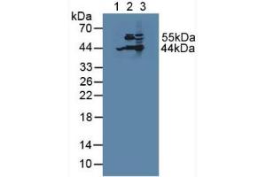 Western blot analysis of (1) Human HepG2 Cells, (2) Porcine Liver Tissue and (3) Mouse Liver Tissue. (ACAT2 抗体  (AA 1-397))