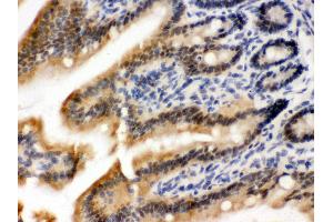 Anti- OGT Picoband antibody,IHC(P) IHC(P): Mouse Intestine Tissue (OGT 抗体  (C-Term))