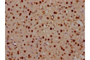 IHC image of ABIN7150394 diluted at 1:100 and staining in paraffin-embedded human brain tissue performed on a Leica BondTM system. (SATB2 抗体  (AA 228-369))