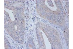 Immunohistochemistry of paraffin-embedded human placenta tissue using ABIN7156785 at dilution of 1:100 (IL12B 抗体  (AA 23-328))