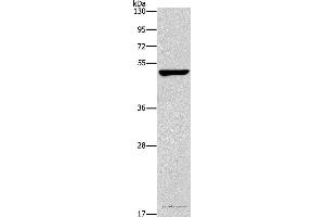 Western blot analysis of A549 cell, using CALCRL Polyclonal Antibody at dilution of 1:200 (CALCRL 抗体)
