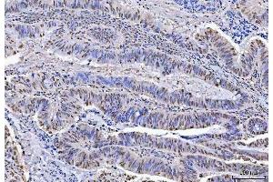 IHC analysis of KAP1 using anti-KAP1 antibody (ABIN3043491).