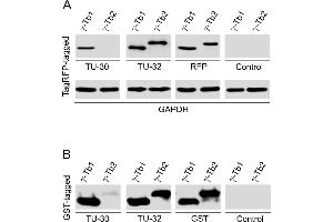 Western blotting analysis of differential reactivity of monoclonal antibodies to γ-tubulin with human γ-tubulin isotypes. (TUBG1 抗体  (AA 434-449))