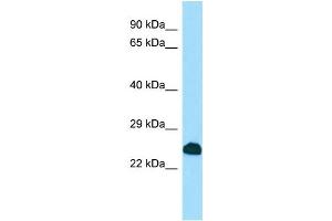 WB Suggested Anti-SCNM1 Antibody Titration: 1. (SCNM1 抗体  (C-Term))