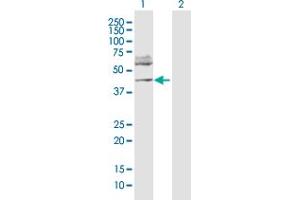 Western Blot analysis of FOXP3 expression in transfected 293T cell line by FOXP3 MaxPab polyclonal antibody. (FOXP3 抗体  (AA 1-431))