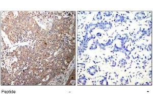 Image no. 1 for anti-Keratin 18 (KRT18) (AA 31-35) antibody (ABIN197580) (Cytokeratin 18 抗体  (AA 31-35))