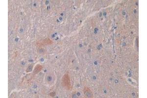 Used in DAB staining on fromalin fixed paraffin- embedded liver tissue (IL18BP 抗体  (AA 29-193))