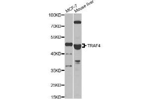 Western blot analysis of extracts of various cell lines, using TRAF4 antibody (ABIN2560520) at 1:1000 dilution.