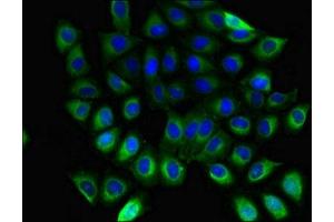 Immunofluorescent analysis of A549 cells using ABIN7154745 at dilution of 1:100 and Alexa Fluor 488-congugated AffiniPure Goat Anti-Rabbit IgG(H+L)