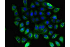 Immunofluorescent analysis of A549 cells using ABIN7154745 at dilution of 1:100 and Alexa Fluor 488-congugated AffiniPure Goat Anti-Rabbit IgG(H+L) (GNB5 抗体  (AA 1-353))