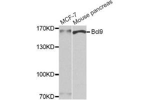 Western blot analysis of extracts of MCF7 and mouse pancreas cell lines, using Bcl9 antibody. (BCL9 抗体)