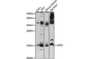 Western blot analysis of extracts of various cell lines, using AVPI1 antibody (ABIN6292453) at 1:1000 dilution. (AVPI1 抗体)