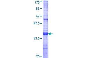Dymeclin Protein (DYM) (AA 343-430) (GST tag)
