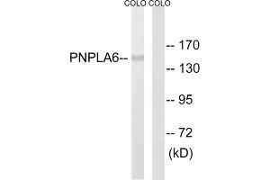 Western blot analysis of extracts from COLO205 cells, using PNPLA6 antibody. (PNPLA6 抗体  (N-Term))