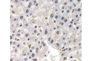 Immunohistochemistry of paraffin-embedded Rat liver using GTF2F1 Polyclonal Antibody at dilution of 1:200 (40x lens). (GTF2F1 抗体)