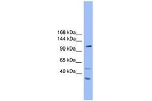 Image no. 1 for anti-StAR-Related Lipid Transfer (START) Domain Containing 8 (STARD8) (AA 201-250) antibody (ABIN6746633) (STARD8 抗体  (AA 201-250))