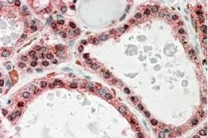 Immunohistochemistry (IHC) image for anti-Potassium Intermediate/small Conductance Calcium-Activated Channel, Subfamily N, Member 2 (KCNN2) (Internal Region) antibody (ABIN571061)