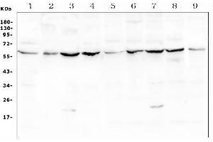 Western blot analysis of Lumican using anti-Lumican antibody (ABIN6719339).